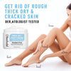 Urea 40% Foot Cream - Exfoliating & Moisturizing