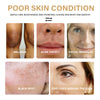 Turmeric Dark Spot Corrector Serum for Face & Body