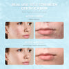 Salicylic Acid Repair Lotion - For Sensitive Skin