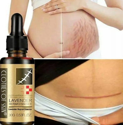 Lavender Repair Serum - Soothing & Scar-Fading